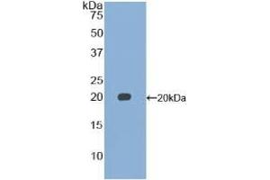 Detection of Recombinant GDF15, Mouse using Polyclonal Antibody to Growth Differentiation Factor 15 (GDF15) (GDF15 抗体  (AA 193-296))