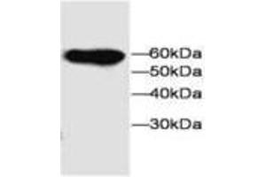 Image no. 1 for anti-Microfibrillar-Associated Protein 3-Like (MFAP3L) antibody (ABIN791551) (MFAP3L 抗体)