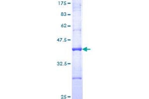 ARF1 Protein (AA 82-181) (GST tag)