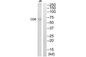 Western Blotting (WB) image for anti-CD6 (CD6) (Internal Region) antibody (ABIN1852261) (CD6 抗体  (Internal Region))