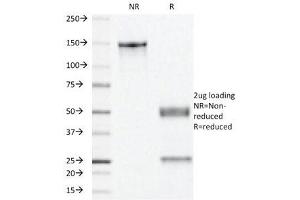 SDS-PAGE Analysis of Purified, BSA-Free Progesterone Receptor Antibody (clone PR501). (Progesterone Receptor 抗体)