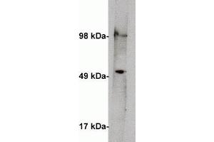 Western blot on human kidney lysate (10 ug/lane) using  anti Serine palmitoyltransferase 1 antibody (cat X2066P) at 1 ug/ml. (SPTLC1 抗体)