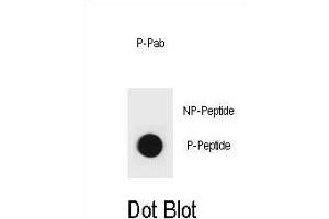 Dot blot analysis of PTEN Antibody (Phospho ) Phospho-specific Pab (ABIN6241056 and ABIN6578943) on nitrocellulose membrane. (PTEN 抗体  (pTyr315))