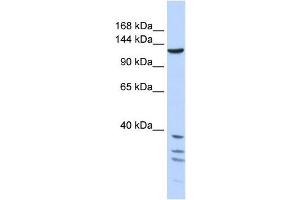 TNKS antibody used at 1 ug/ml to detect target protein. (TNKS 抗体  (Middle Region))