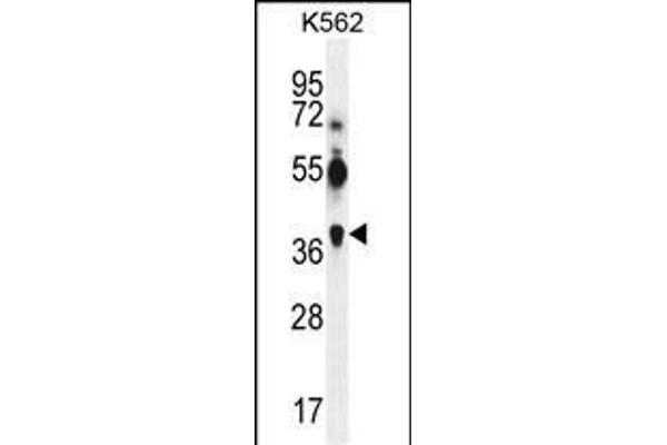 MAGEA12 抗体  (N-Term)
