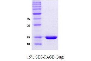 SDS-PAGE (SDS) image for alpha Synuclein DeltaNAC (AA 61-95) protein (ABIN666814) (alpha Synuclein DeltaNAC (AA 61-95) 蛋白)