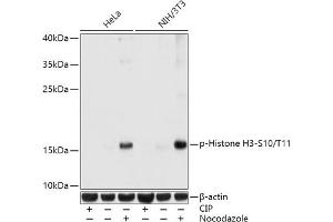 Western blot analysis of extracts of various cell lines, using Phospho-Histone H3-S10/T11 antibody (ABIN7267688) at 1:1000 dilution. (Histone 3 抗体  (H3S10p, H3T11p))