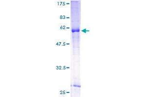 Image no. 1 for Wingless-Type MMTV Integration Site Family, Member 7B (WNT7B) (AA 32-349) protein (GST tag) (ABIN1325370) (WNT7B Protein (AA 32-349) (GST tag))