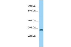 Host: Rabbit Target Name: UCHL1 Sample Type: Fetal Kidney lysates Antibody Dilution: 1. (UCHL1 抗体  (Middle Region))