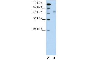 WWP2 antibody used at 1 ug/ml to detect target protein. (WWP2 抗体  (Middle Region))