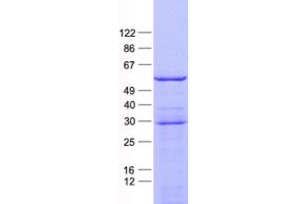 PFKFB2 Protein (His tag)