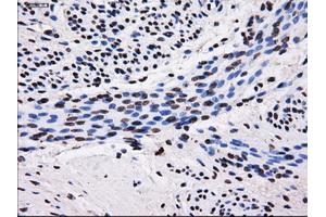 Immunohistochemical staining of paraffin-embedded endometrium tissue using anti-SORDmouse monoclonal antibody. (SORD 抗体)