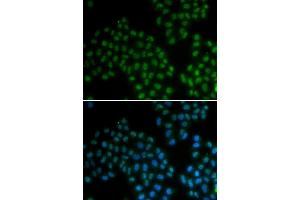Immunofluorescence analysis of MCF7 cell using SOX2 antibody. (SOX2 抗体  (AA 1-140))