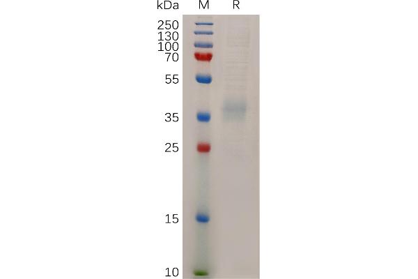 NPC1L1 Protein (AA 22-284) (His tag)