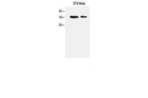 Western Blot analysis of 3T3, Hela cells using α-SMA Polyclonal Antibody at dilution of 1:1500. (alpha-SMA 抗体)