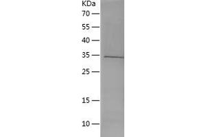 Western Blotting (WB) image for Melanoma Antigen Family D, 1 (MAGED1) (AA 504-760) protein (His tag) (ABIN7123901) (MAGED1 Protein (AA 504-760) (His tag))