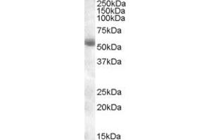 Image no. 1 for anti-Transmembrane Protease, serine 2 (TMPRSS2) (AA 518-529) antibody (ABIN342990) (TMPRSS2 抗体  (AA 518-529))