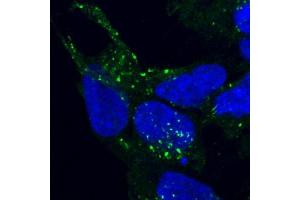 Immunofluorescence (IF) image for anti-Vacuolar Protein Sorting 35 (VPS35) antibody (ABIN5906217) (VPS35 抗体)