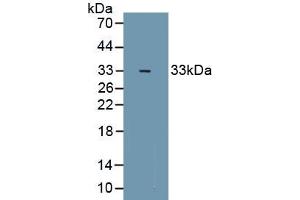 Detection of Recombinant ZFHX1B, Mouse using Polyclonal Antibody to Zinc Finger Homeobox Protein 1B (ZFHX1B) (ZEB2 抗体  (AA 962-1215))
