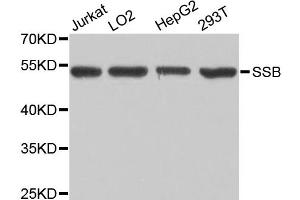 Western blot analysis of extracts of various cell lines, using SSB antibody (ABIN5970231) at 1/1000 dilution. (SSB 抗体)