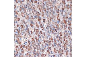 Immunohistochemistry of paraffin-embedded human liver using TIMM50 Rabbit mAb (ABIN1513120, ABIN3022092, ABIN3022093 and ABIN7101443) at dilution of 1:100 (40x lens). (TIMM50 抗体)