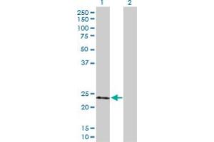 Western Blot analysis of TIMP2 expression in transfected 293T cell line by TIMP2 MaxPab polyclonal antibody. (TIMP2 抗体  (AA 1-220))