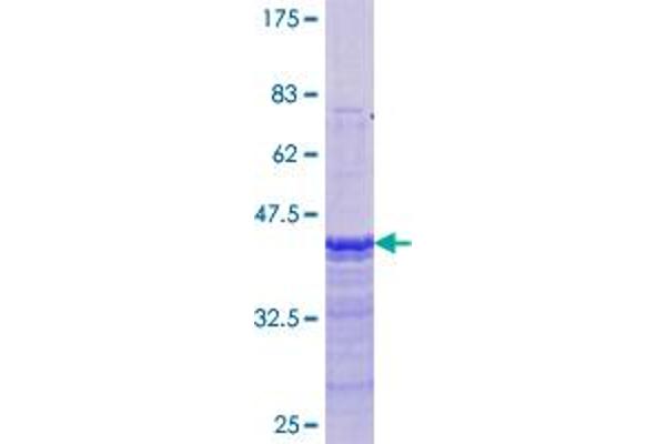 Estrogen Receptor alpha Protein (AA 41-140) (GST tag)