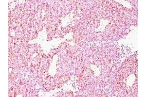 Immunohistochemistry (IHC) image for anti-Chromogranin A (CHGA) antibody (ABIN3024536)