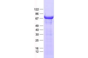 Validation with Western Blot (PPP2R5D Protein (His tag))