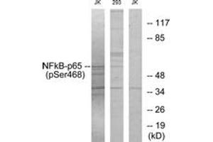 Western blot analysis of extracts from Jurkat cells and 293 cells, using NF-kappaB p65 (Phospho-Ser468) Antibody. (NF-kB p65 抗体  (pSer468))