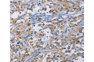 Immunohistochemistry (IHC) image for anti-RPTOR Independent Companion of mTOR, Complex 2 (RICTOR) antibody (ABIN2422798) (RICTOR 抗体)