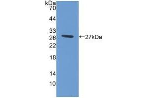 Detection of Recombinant ABCG1, Human using Polyclonal Antibody to ATP Binding Cassette Transporter G1 (ABCG1) (ABCG1 抗体  (AA 79-312))