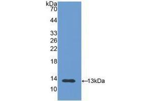 Western blot analysis of recombinant Human PIGR. (PIGR 抗体  (AA 19-120))