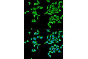 Immunofluorescence analysis of MCF-7 cells using CES2 antibody (ABIN5970708). (CES2 抗体)