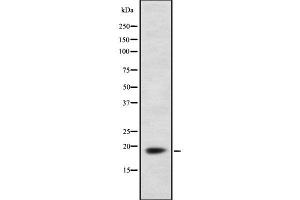 Western blot analysis of FDX1 using HepG2 whole  lysates. (Ferredoxin1 (FDX1) (Internal Region) 抗体)