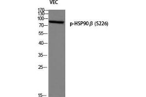 Western Blot (WB) analysis of VEC using p-HSP90beta (S226) antibody. (HSP90AB1 抗体  (pSer226))