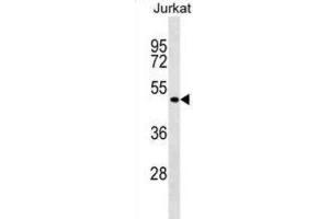 Western Blotting (WB) image for anti-Forkhead Box B2 (FOXB2) antibody (ABIN2999275) (FOXB2 抗体)