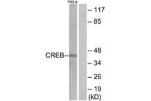 Western blot analysis of extracts from HeLa cells, treated with UV 15', using CREB (Ab-129) Antibody. (CREB1 抗体  (AA 96-145))