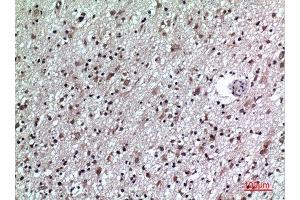 Immunohistochemistry (IHC) image for anti-CD84 (CD84) (Internal Region) antibody (ABIN3187786)