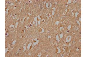 IHC image of nphHU diluted at 1:100 and staining in paraffin-embedded human brain tissue performed on a Leica BondTM system. (TBK1 抗体  (AA 166-180))