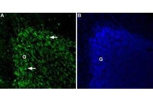 Expression of Two pore calcium channel protein 2 in rat cerebellum - Immunohistochemical staining of Two pore calcium channel protein 2 in rat cerebellum using Anti-TPCN2 Antibody (ABIN7043872, ABIN7044037 and ABIN7044038). (TPCN2 抗体  (2nd Lumenal Region))