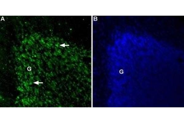 TPCN2 抗体  (2nd Lumenal Region)