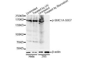 Western blot analysis of extracts of HeLa and 293 cells, using Phospho-SMC1A-S957 antibody (ABIN5969934) at 1/1000 dilution. (SMC1A 抗体  (pSer957))