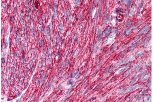 Human Uterus, Smooth Muscle (formalin-fixed, paraffin-embedded) stained with CD44 antibody ABIN239810 at 10 ug/ml followed by biotinylated anti-mouse IgG secondary antibody ABIN481714, alkaline phosphatase-streptavidin and chromogen. (CD44 抗体)