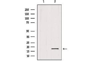 Western blot analysis of extracts from 293, using SKP1 Antibody. (SKP1 抗体  (Internal Region))