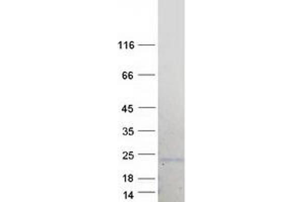 BCL7B Protein (Transcript Variant 2) (Myc-DYKDDDDK Tag)