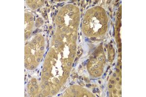 Immunohistochemistry of paraffin-embedded human kidney using PTK2 antibody (ABIN5971141) at dilution of 1/100 (40x lens). (FAK 抗体)