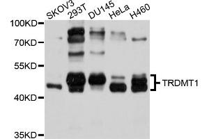Western blot analysis of extracts of various cell lines, using TRDMT1 antibody (ABIN4905485) at 1:1000 dilution. (Dnmt2 抗体)