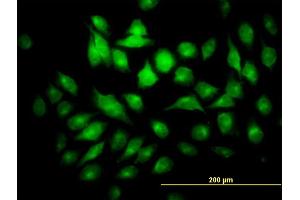 Immunofluorescence of monoclonal antibody to PYCRL on HeLa cell. (PYCRL 抗体  (AA 32-131))