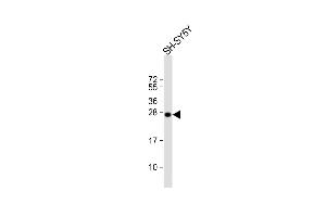 Anti-SN Antibody (Center) at 1:1000 dilution + SH-SY5Y whole cell lysate Lysates/proteins at 20 μg per lane. (SNAP25 抗体  (AA 36-63))